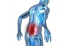 Leğen Kemiği İltihabı Belirtileri ve Tedavisi Leğen Kemiği İltihabı Belirtileri ve Tedavisi