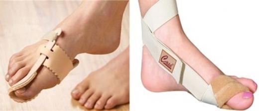 Ayakta Çıkan Kemik Belirtileri ve Tedavisi