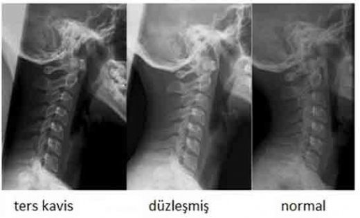 Boyun Kemiği Görevleri