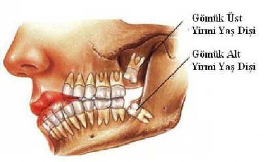 Çene Kemiği Özellikleri 