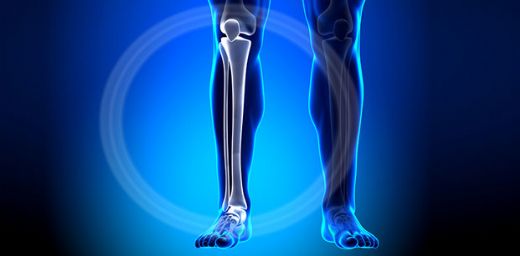 Kaval Kemiği Kırığı Belirtileri ve Tedavisi