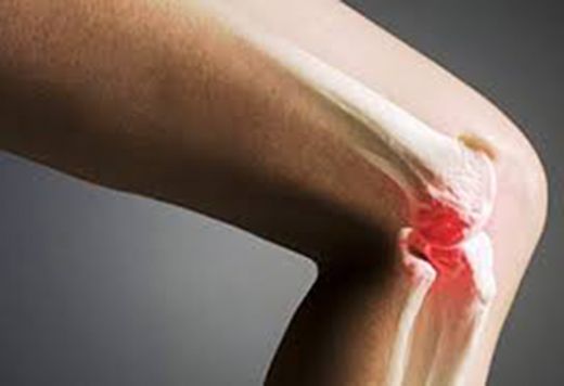 Kemik İltihabı Belirtileri ve Tedavisi