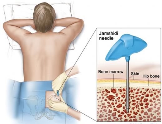 Kemik Testi Nasıl Yapılır?