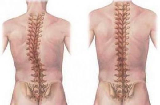 Kuyruk Kemiği Eğriliği